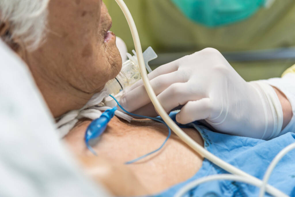 tracheostomy